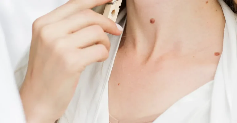 Mole On Neck Meaning For Females – An In-Depth Look