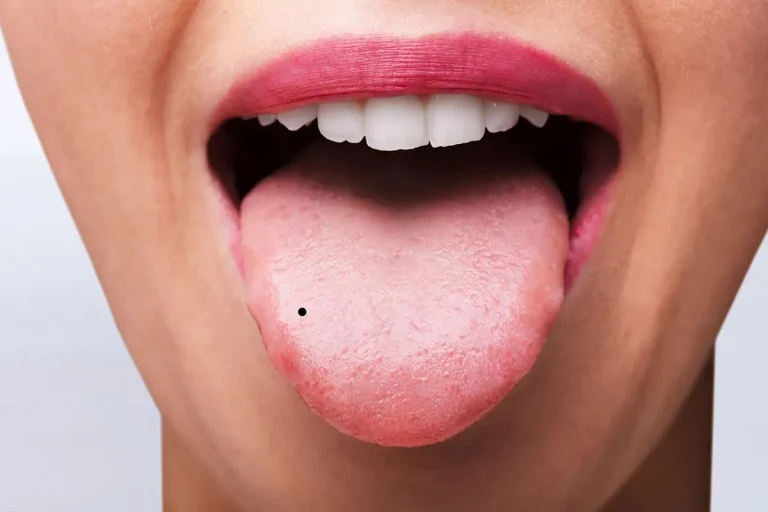 Black Spots On The Tongue: Spiritual Meanings And Causes
