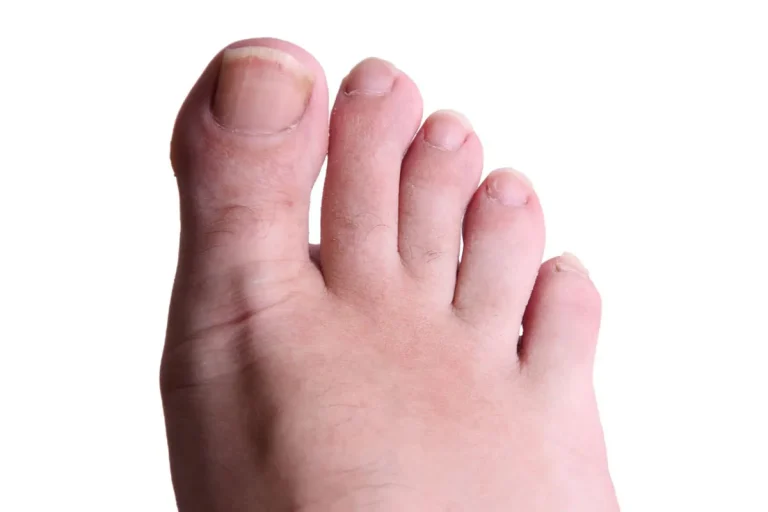 The Spiritual Meaning Of Webbed Toes